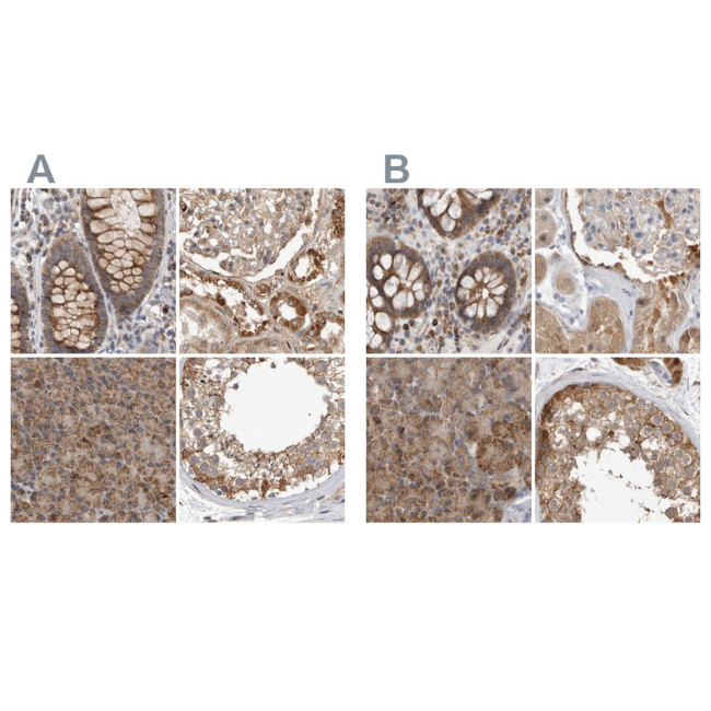 CCBL2 Antibody in Immunohistochemistry (IHC)