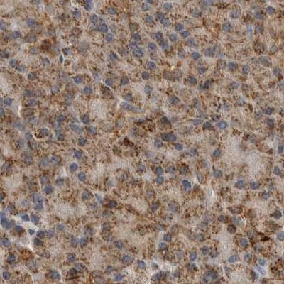 CCBL2 Antibody in Immunohistochemistry (IHC)