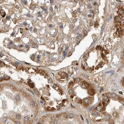 CCBL2 Antibody in Immunohistochemistry (IHC)