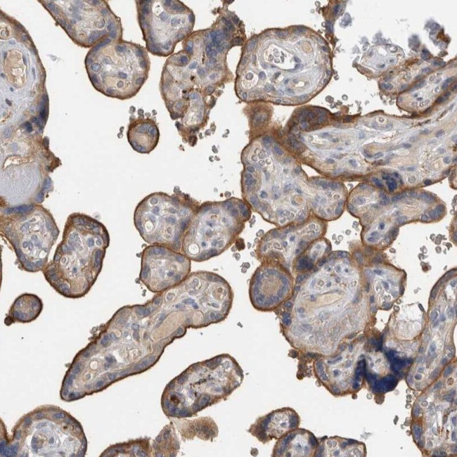 TBCE Antibody in Immunohistochemistry (IHC)