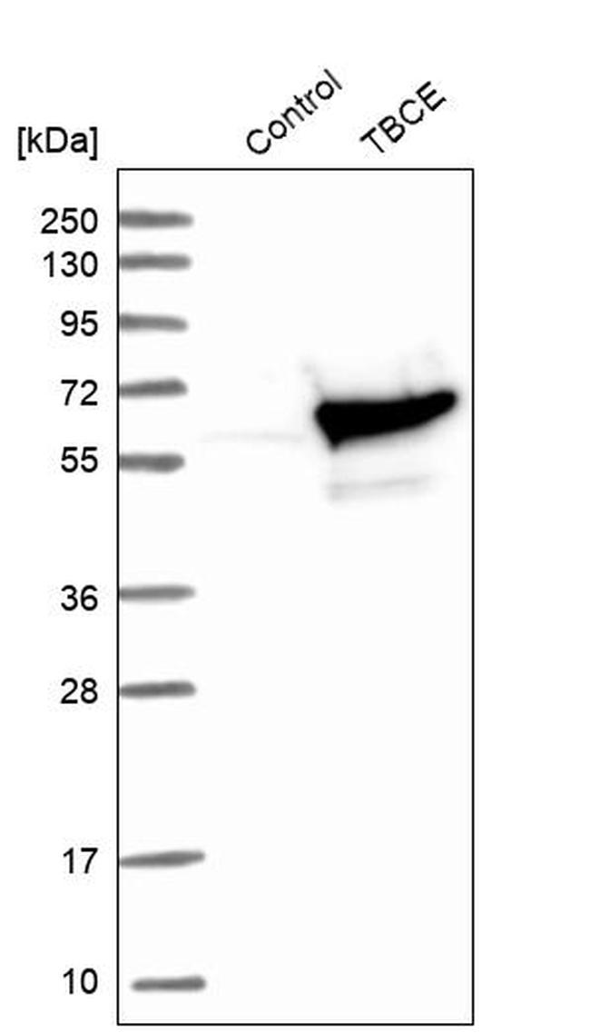 TBCE Antibody in Western Blot (WB)