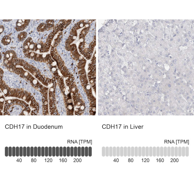 CDH17 Antibody in Immunohistochemistry (IHC)