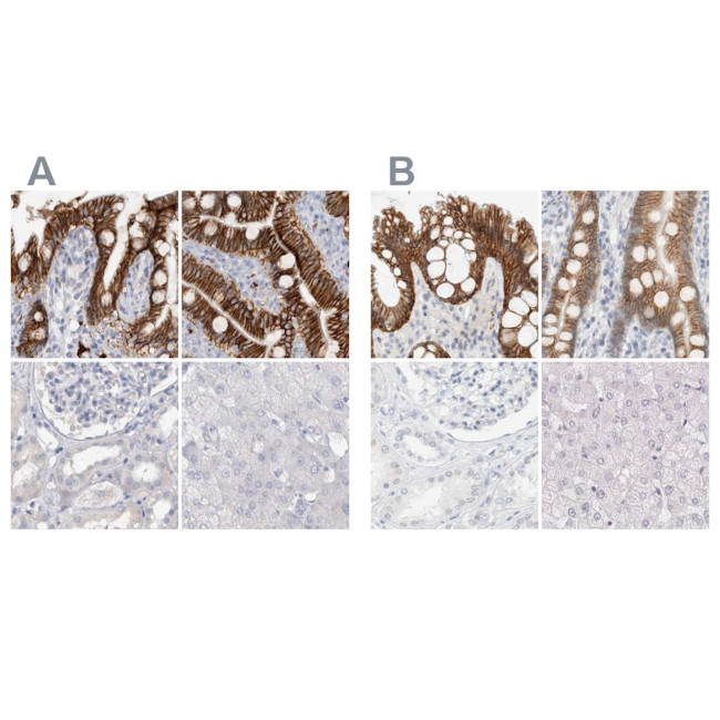 CDH17 Antibody in Immunohistochemistry (IHC)