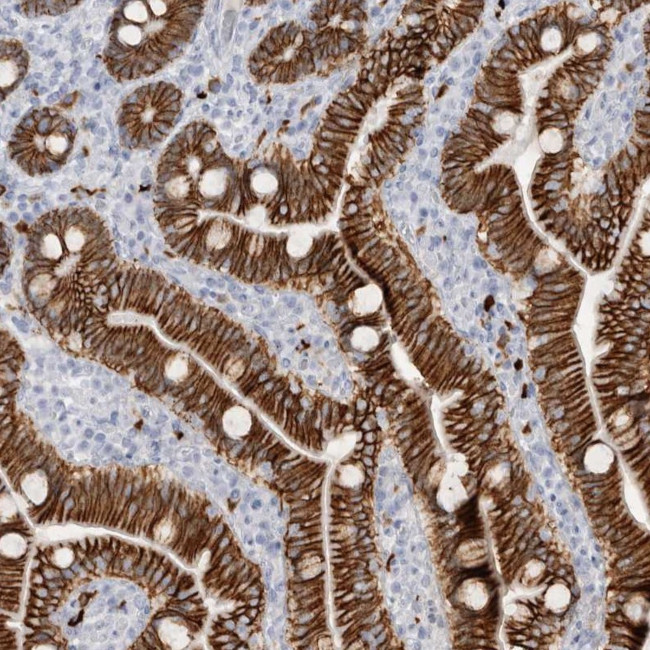 CDH17 Antibody in Immunohistochemistry (IHC)