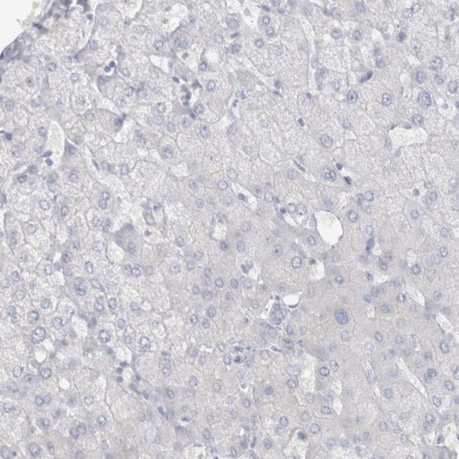 CDH17 Antibody in Immunohistochemistry (IHC)