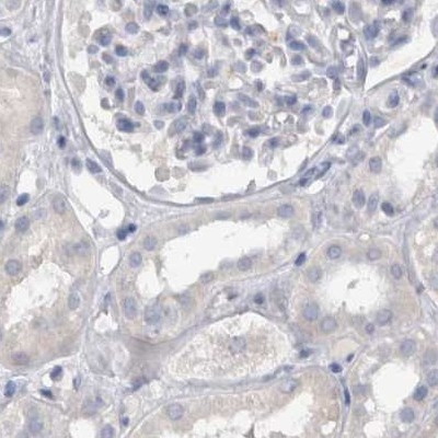 CDH17 Antibody in Immunohistochemistry (IHC)