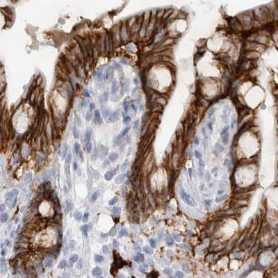 CDH17 Antibody in Immunohistochemistry (IHC)