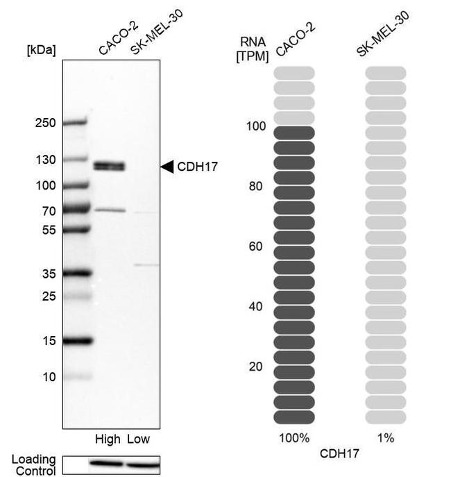 CDH17 Antibody in Western Blot (WB)