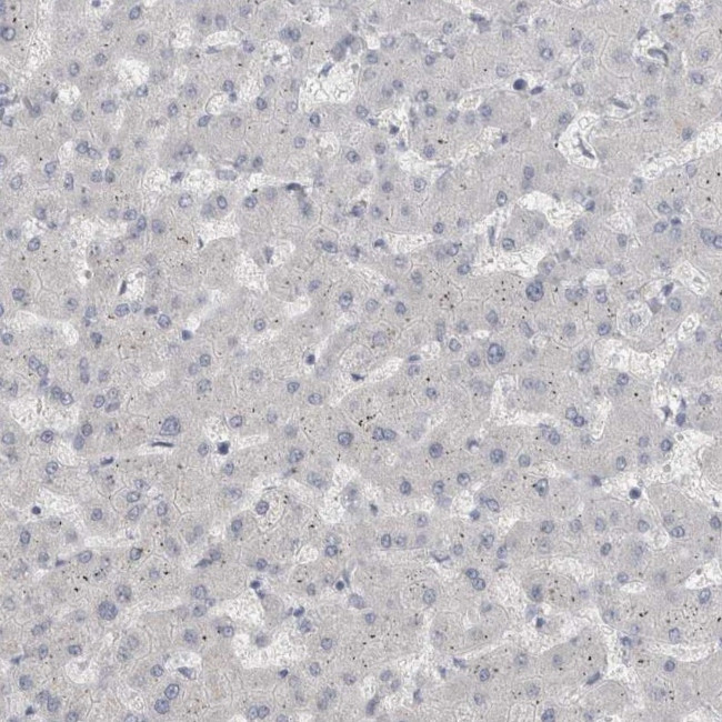 ADAM2 Antibody in Immunohistochemistry (IHC)