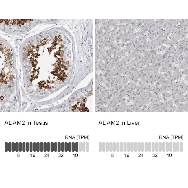 ADAM2 Antibody