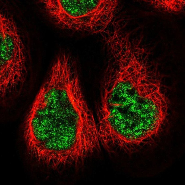 NCAPG2 Antibody in Immunocytochemistry (ICC/IF)