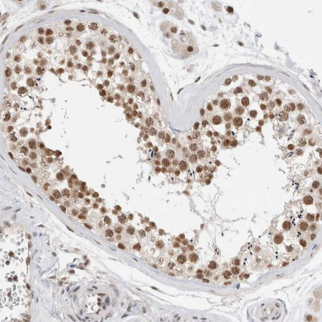 NCAPG2 Antibody in Immunohistochemistry (IHC)