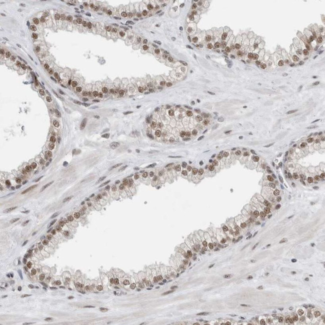 NCAPG2 Antibody in Immunohistochemistry (IHC)