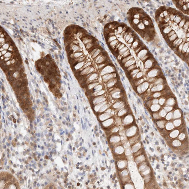 STARD10 Antibody in Immunohistochemistry (IHC)