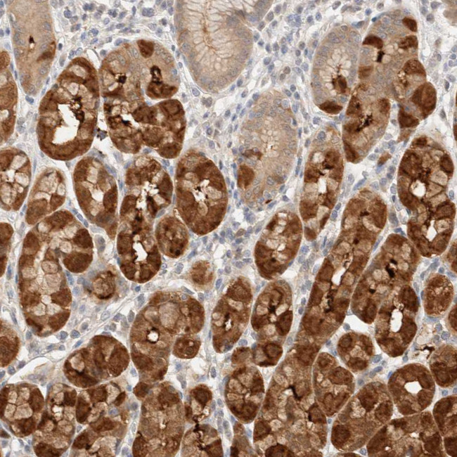 STARD10 Antibody in Immunohistochemistry (IHC)