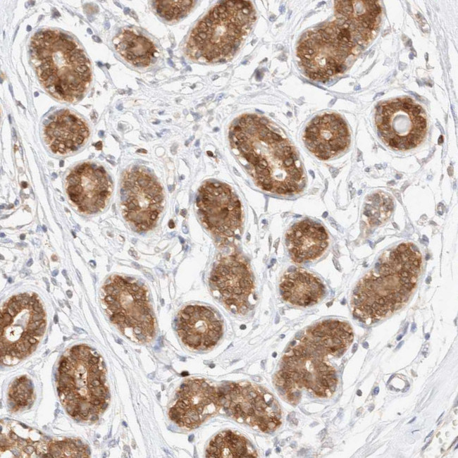 STARD10 Antibody in Immunohistochemistry (IHC)