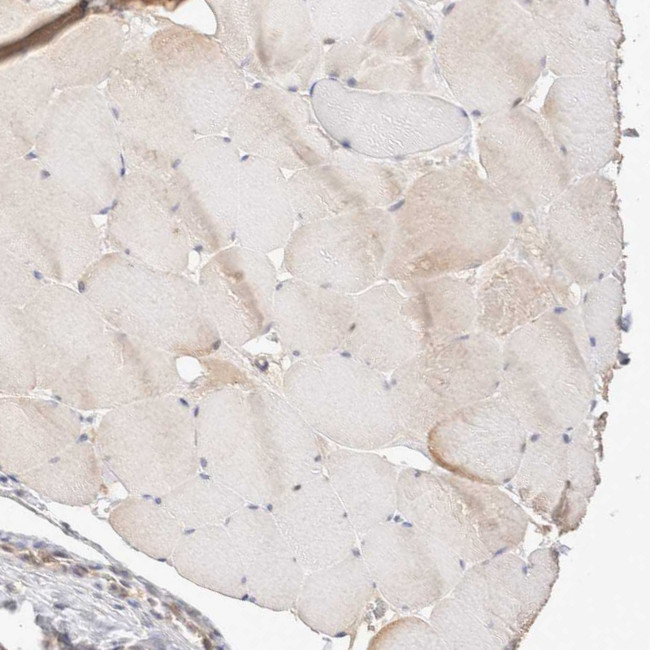 STARD10 Antibody in Immunohistochemistry (IHC)