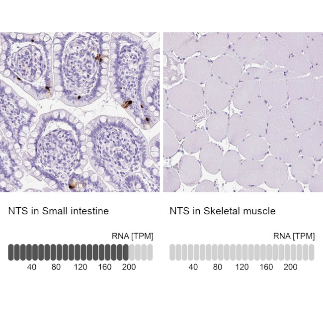 NTS Antibody in Immunohistochemistry (IHC)