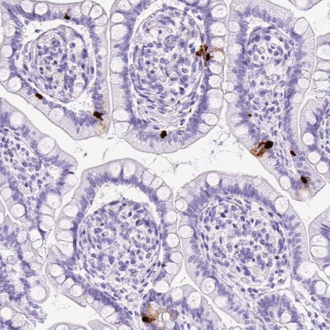 NTS Antibody in Immunohistochemistry (IHC)