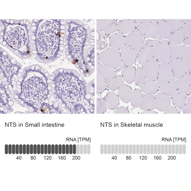 NTS Antibody