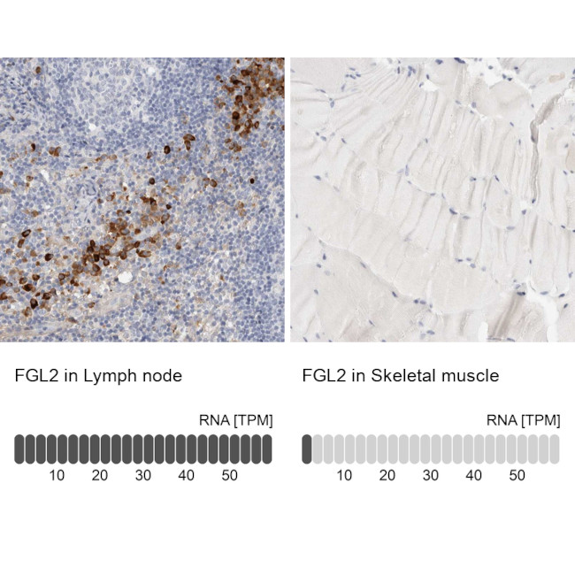 FGL2 Antibody in Immunohistochemistry (IHC)