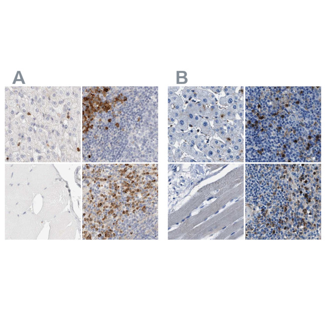 FGL2 Antibody in Immunohistochemistry (IHC)