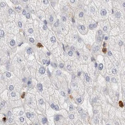 FGL2 Antibody in Immunohistochemistry (IHC)