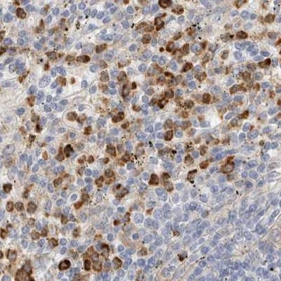 FGL2 Antibody in Immunohistochemistry (IHC)