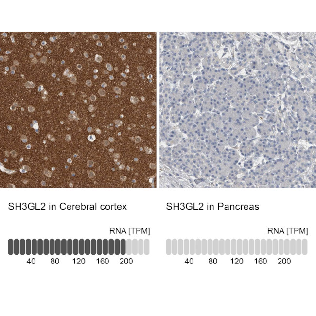 SH3GL2 Antibody in Immunohistochemistry (IHC)