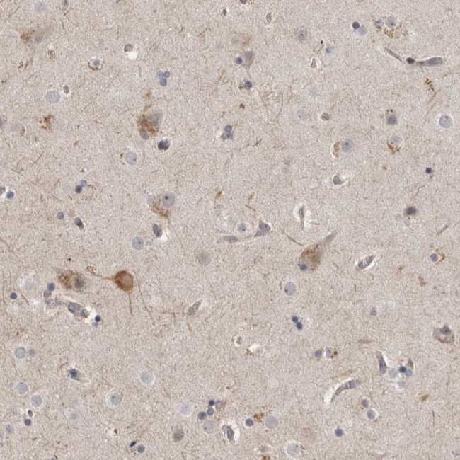 MUPP1 Antibody in Immunohistochemistry (IHC)