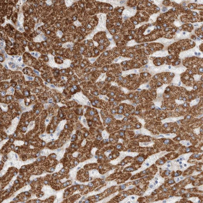 ECHDC2 Antibody in Immunohistochemistry (IHC)