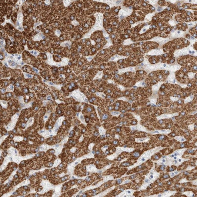 ECHDC2 Antibody in Immunohistochemistry (IHC)