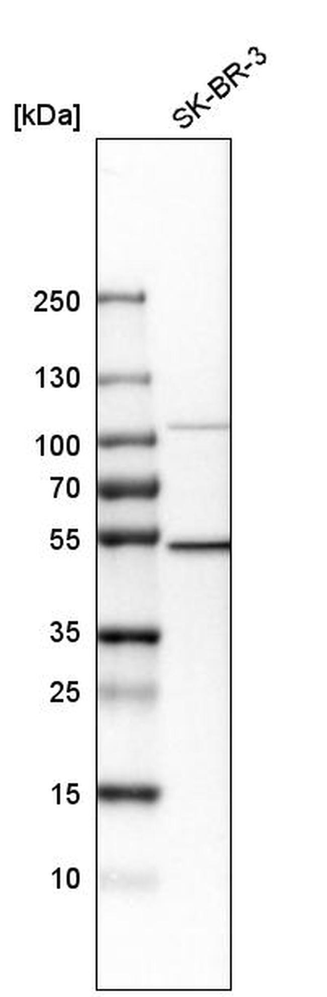 POLD2 Antibody in Western Blot (WB)