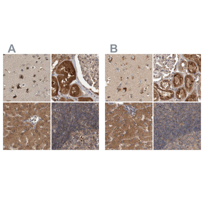 TRMT61B Antibody in Immunohistochemistry (IHC)