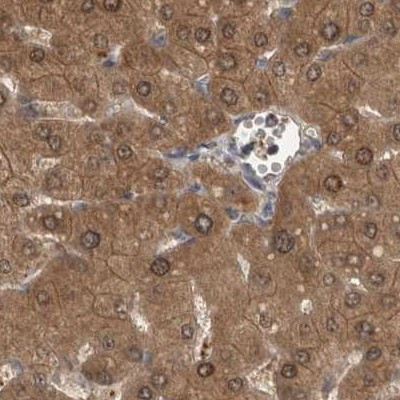 TRMT61B Antibody in Immunohistochemistry (IHC)