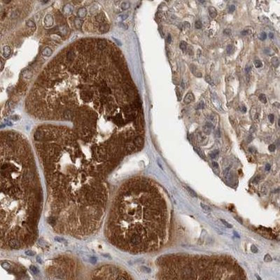 TRMT61B Antibody in Immunohistochemistry (IHC)