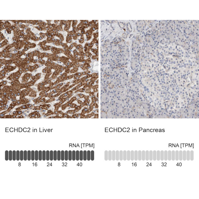 ECHDC2 Antibody in Immunohistochemistry (IHC)