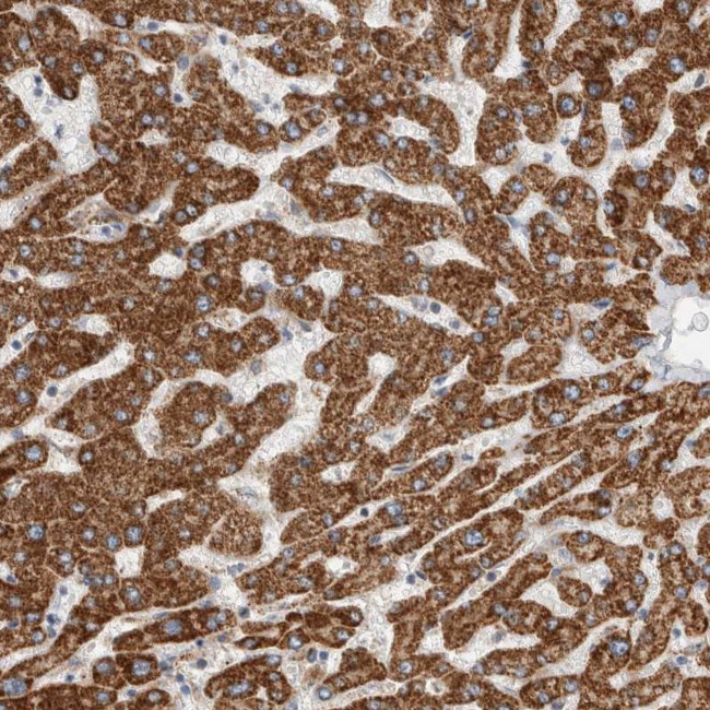 ECHDC2 Antibody in Immunohistochemistry (IHC)