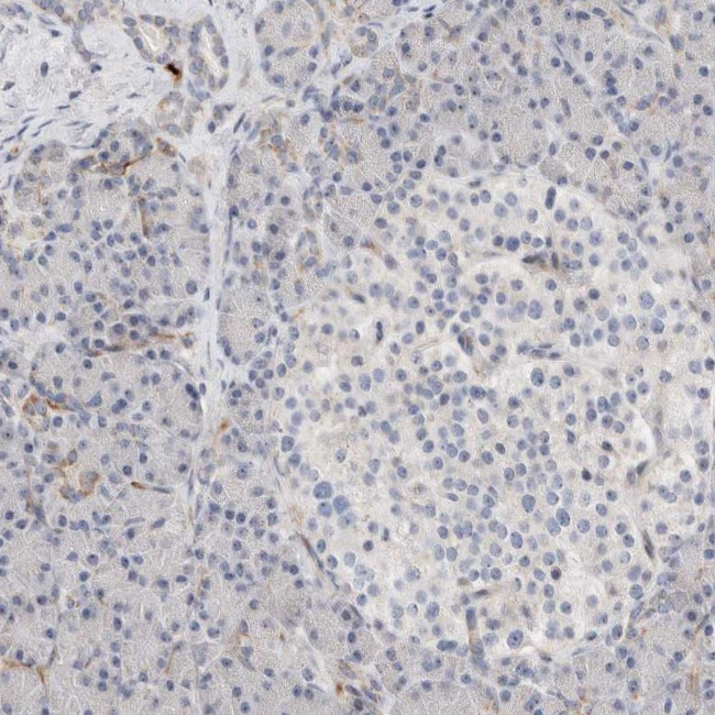 ECHDC2 Antibody in Immunohistochemistry (IHC)