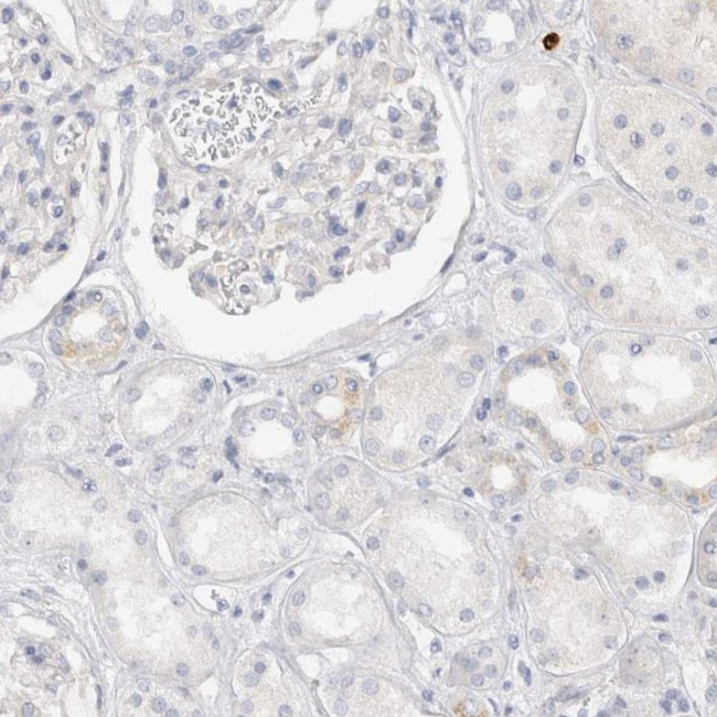 SPINK2 Antibody in Immunohistochemistry (IHC)