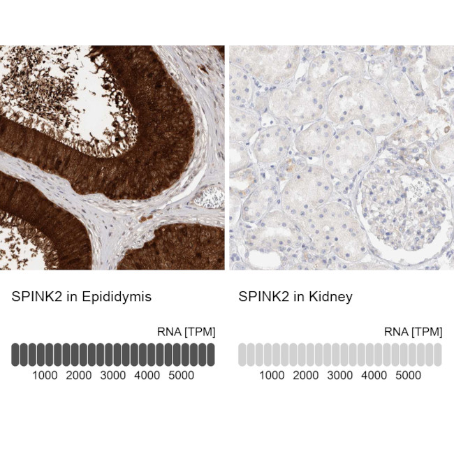 SPINK2 Antibody