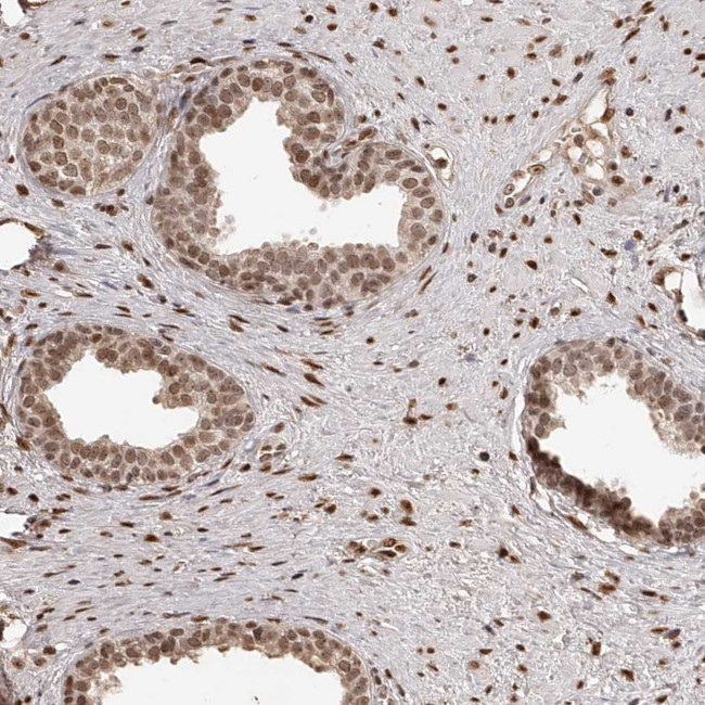 ZNF503 Antibody in Immunohistochemistry (IHC)