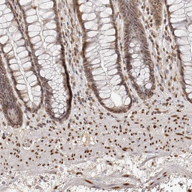 ZNF503 Antibody in Immunohistochemistry (IHC)