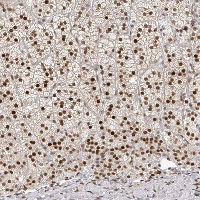 ZNF503 Antibody in Immunohistochemistry (IHC)