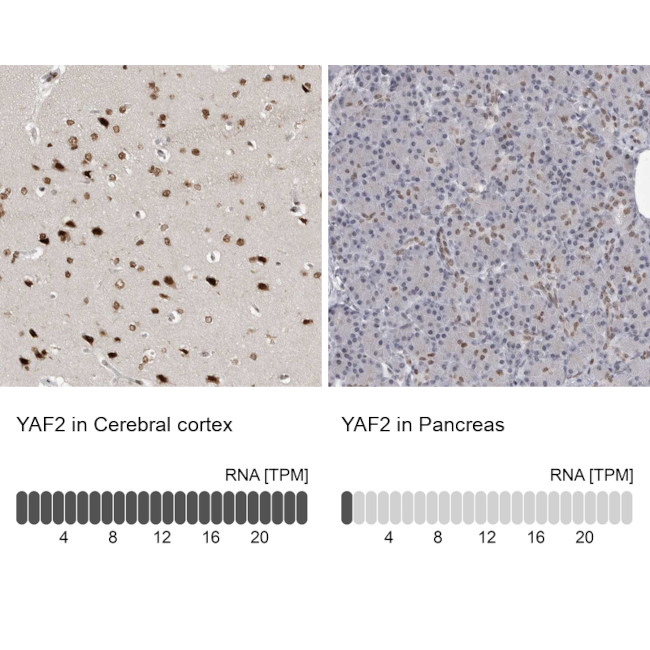 YAF2 Antibody in Immunohistochemistry (IHC)