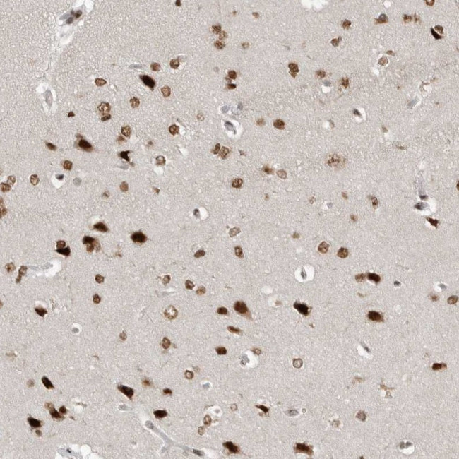 YAF2 Antibody in Immunohistochemistry (IHC)