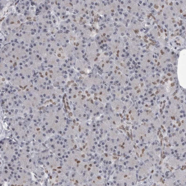 YAF2 Antibody in Immunohistochemistry (IHC)