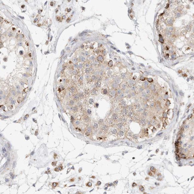 SLC25A26 Antibody in Immunohistochemistry (IHC)