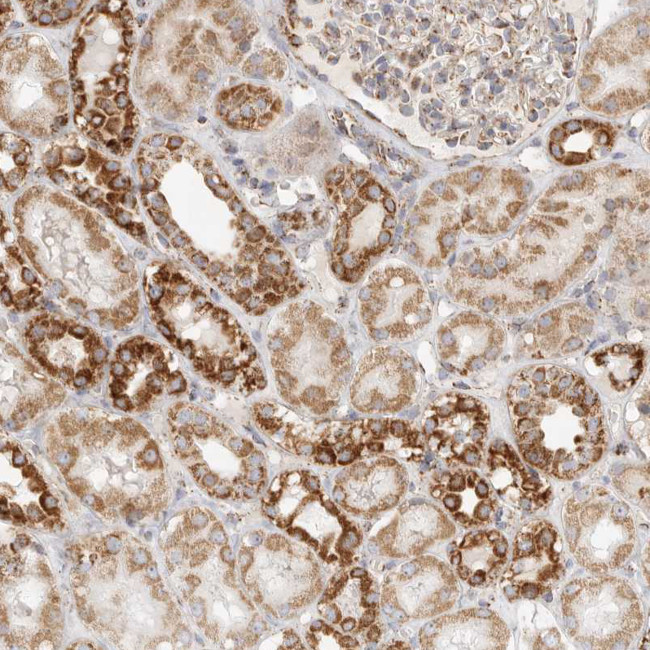 SLC25A26 Antibody in Immunohistochemistry (IHC)