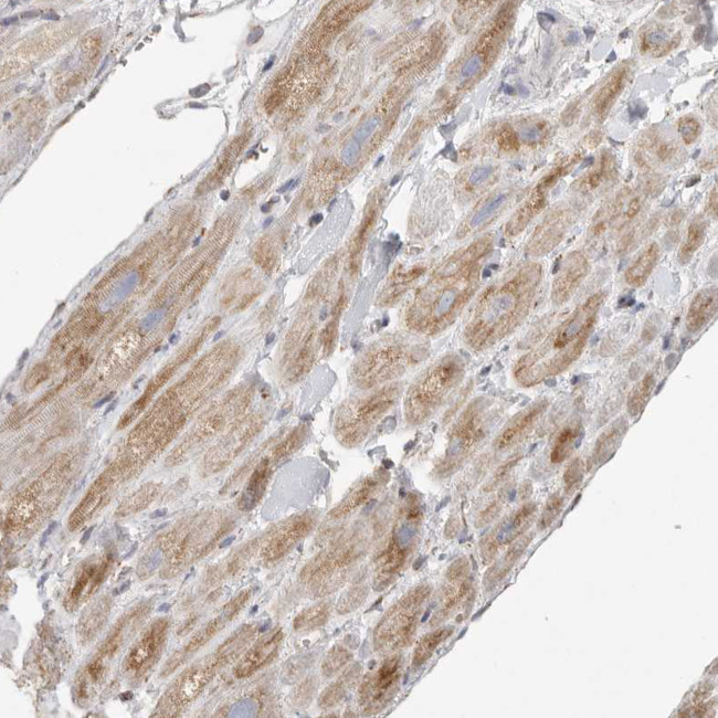 SLC25A26 Antibody in Immunohistochemistry (IHC)